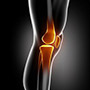 Bilateral Knee Surgery